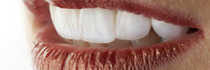 Ceramic teeth