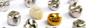 metals in dentistry