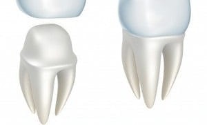 crowns2.jpg