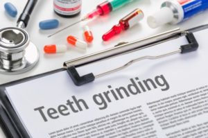 Cosmetic Dentistry when you Have Bruxism