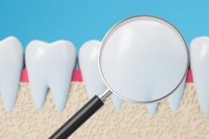 White fillings are indistinguishable from tooth enamel White fillings are indistinguishable from tooth enamel