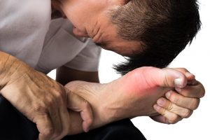 Hallux or Metatarsophalangeal Joint Pain, Male Foot Pain