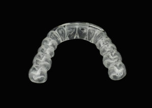 custom mouth guard