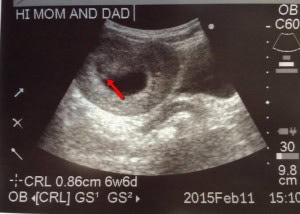 1922071_10204725265345949_2688661031626963334_n