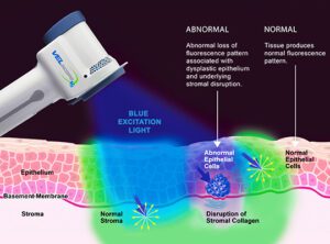 tissue-fluorescence-visualization
