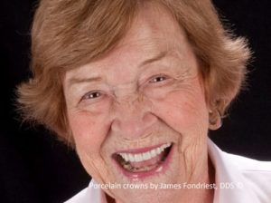 Portrait with beautiful porcelain crowns Best Porcelain Crowns Chicago