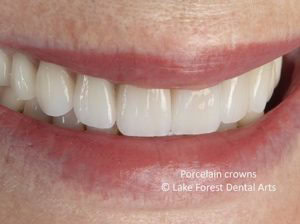 Transform my smile