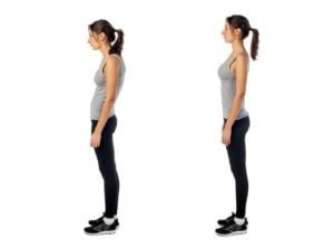 Posture and TMJ Disorder