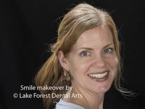 Dental cosmetics
