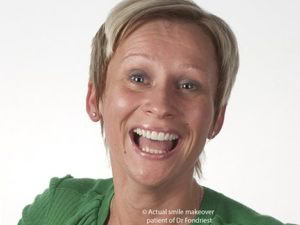 Cosmetic Dental Changes