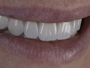 Quality cosmetic dentistry in Chicago