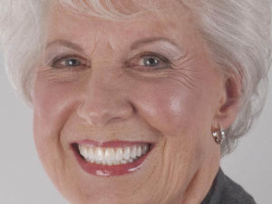 teeth veneers