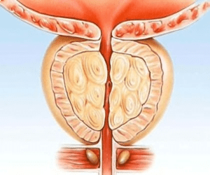 Stop Nighttime Urination with This Simple Trick for Men Over 35 8 GF 8