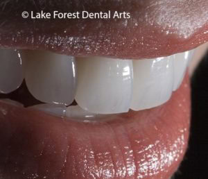 Cosmetic dental treatment planning