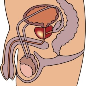 an anatomic image of the prostate gland,