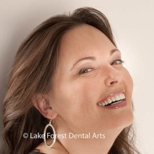 Seamless restorations