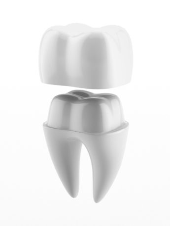 Fake ceramic teeth