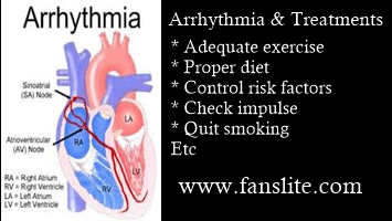 Arrhythmia Treatment