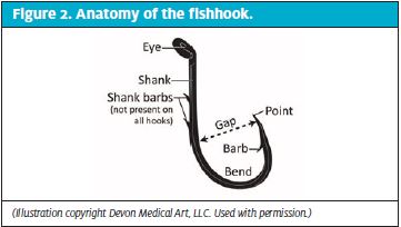 Anatomy of the Fishhook