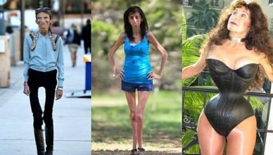 Skinniest People in the world