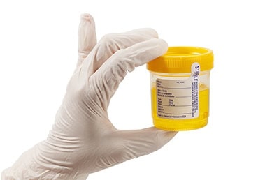 Drug Screening Market Expected to See Healthy Growth Through 2022 Drug Screening Market Expected to See Healthy Growth Through 2022