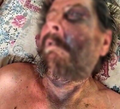 DARBEDİLEN VE METRUK BİR EVDE ÖLÜME TERK EDİLEN ADAMIN, SALDIRGAN KİŞİLERCE "SEN BENİM ABİMİN CENAZESİNE NEDEN GELMEDİN" DENİLEREK DÖVÜLDÜĞÜ ÖĞRENİLDİ. (ARŞİV)