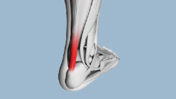 Kas yra sausgyslės?