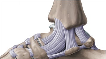 Kas yra sąnarių raiščiai