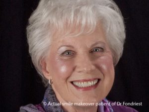 Cosmetic smile makeover this patient had some of the Most Popular Cosmetic Dental Procedures available