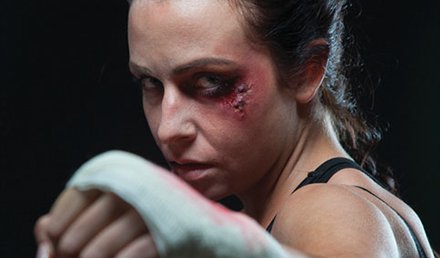 Mixed Martial Arts Injuries Mixed Martial Arts Injuries