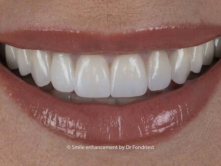 Not all cosmetic Dentistry is the same Not all Cosmetic dentistry is the same.