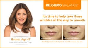 Belotero Before and After Photos