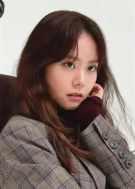 Han Seungyeon KARA gangguan saraf