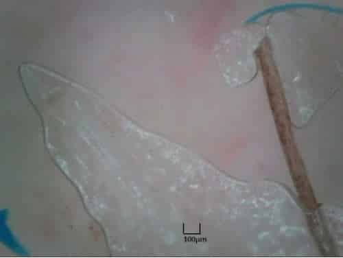 morgellons_fiber_size_compared_to_human_hair