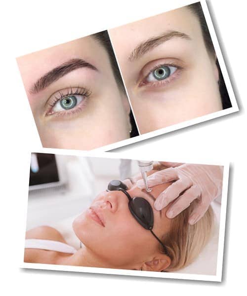 При выполнении татуажа бровей используется специальный пигмент, который содержит различные оттенки для создания желаемого цвета. Однако, цвет пигмента может измениться из-за разных факторов, таких как реакция организма на процедуру, некачественный материал или повышенная восприимчивость к красителю. Если в редких случаях брови синеют, зеленеют или рыжеют, то это может быть связано с неправильным выбором оттенка или нарушением технологии работы мастера.