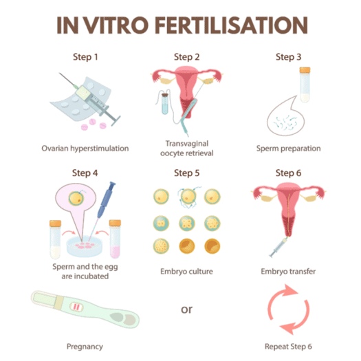 IVF-Process