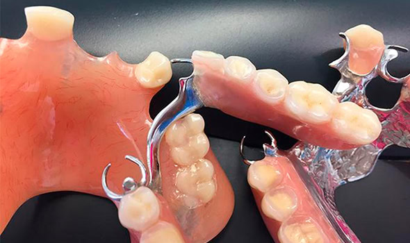 protesis 590x350 protesis 590x350