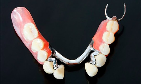 protesis de base de metal
