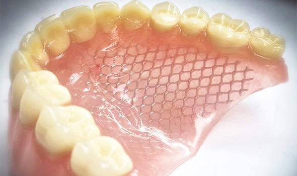 protesis total 590x350 malla