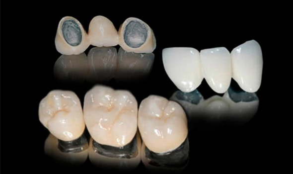 puente metal porcelana 590x350