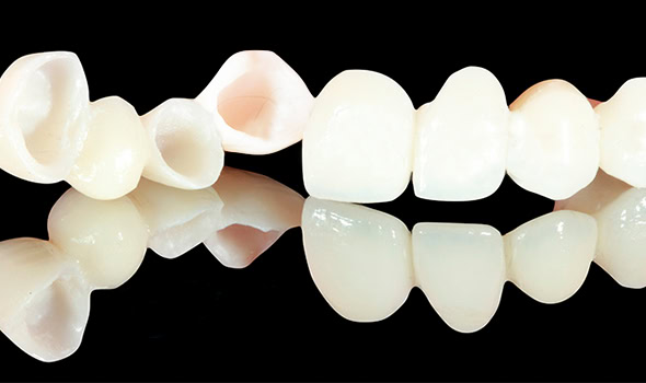 puente zirconio 590x350