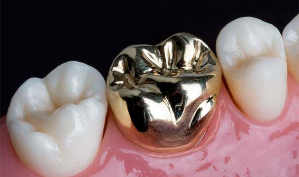 corona metal 590x350