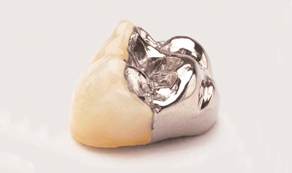 corona metal ivocron 590x350