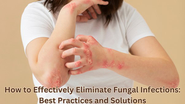 How to Effectively Eliminate Fungal Infections