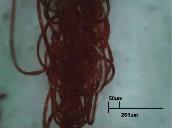 black-speck-Morgellons