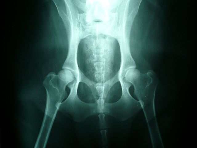 X-Ray Normal Canine Hip Joints