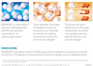 Radiesse Mechanism of Action Illustration
