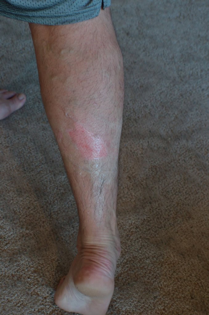 but then he had to beat it out and go scrub the skin off, I think this looks a lot cleaner than it feels... OUCH! 