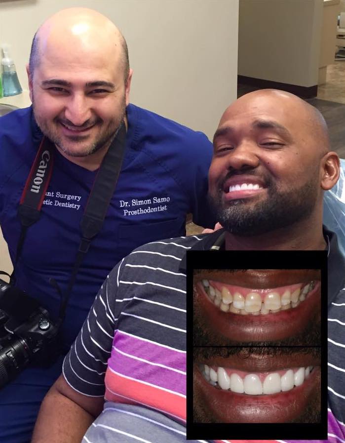 An Extreme Smile Makeover For The New Year | Houston, TX