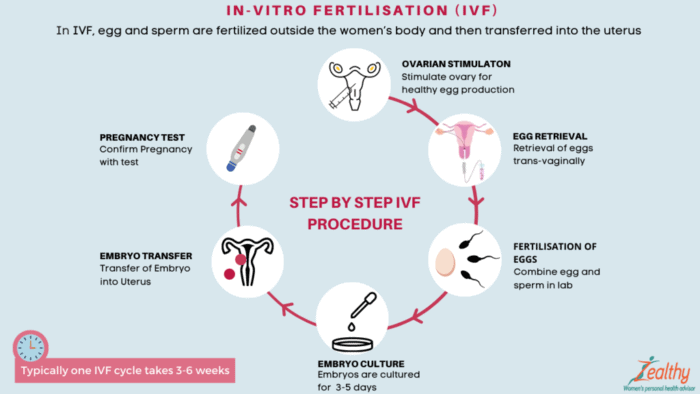 IVF Process